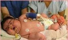 بزرگ ترین نوزاد جهان چیست؟سنگین ترین نوزاد تازه متولد شده
