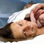 Следродилна матка в ранния следродилен период