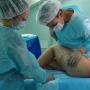 Chirurgia plastica per la riassegnazione di genere all'estero