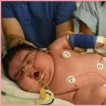 Kaj je največji dojenček na svetu Najtežji novorojenček
