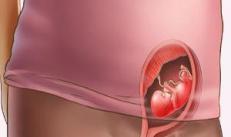Sintomi di minaccia di aborto spontaneo: all'inizio della gravidanza, nel secondo e terzo trimestre L'aborto spontaneo si verifica nel secondo trimestre