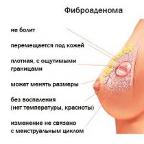 Tumor payudara pada wanita: perbedaan gejala